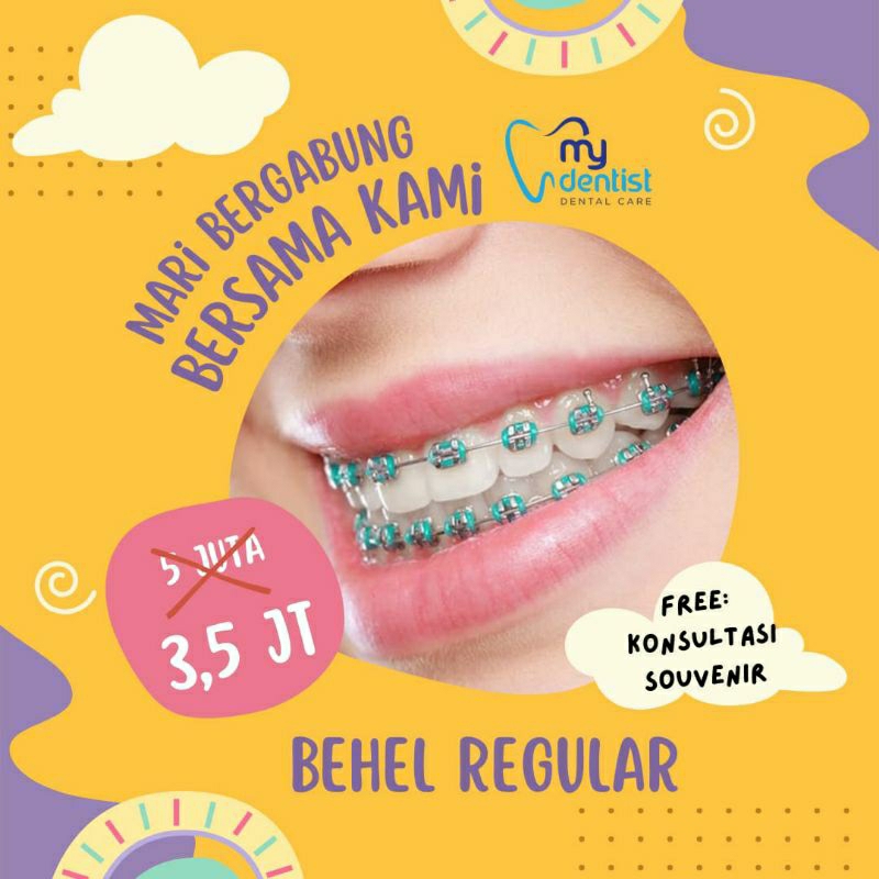 Voucher Perawatan Behel Gigi Regular / orthodonti / Kawat gigi Metal