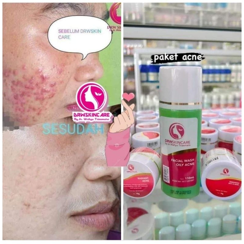 PAKET RADIANT ACNE DRW SKINCARE