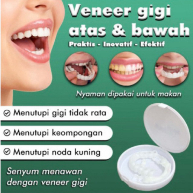 Veneer Gigi Atas Bawah