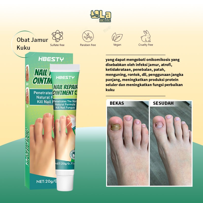 Obat Jamur Kuku obat kuku jamur dan rusak vitamin kuku rusak perawatan kuku 20g Obat cantengan obat 