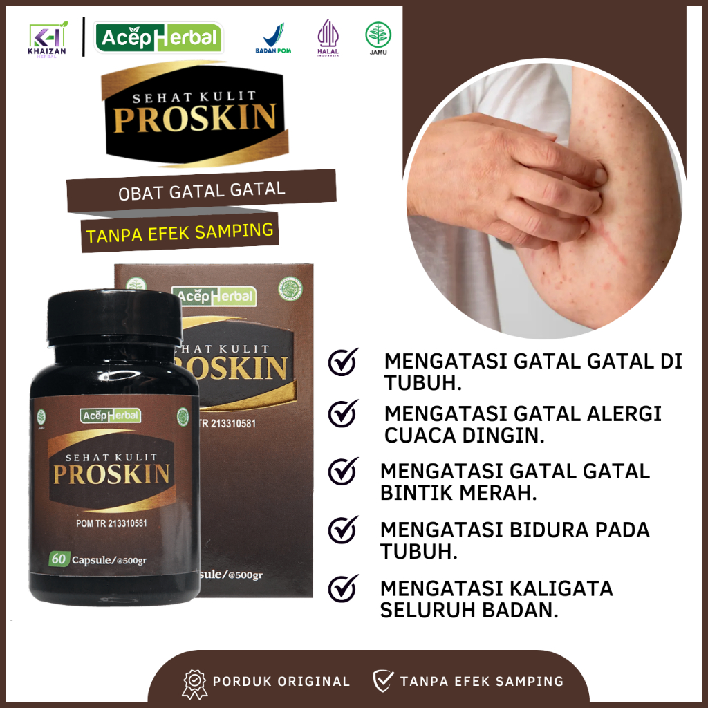PROSKIN Solusi Untuk Mengobati Gatal Gatal di Tubuh Gatal Alergi Cuaca Dingin Gatal Bintik Merah Gat