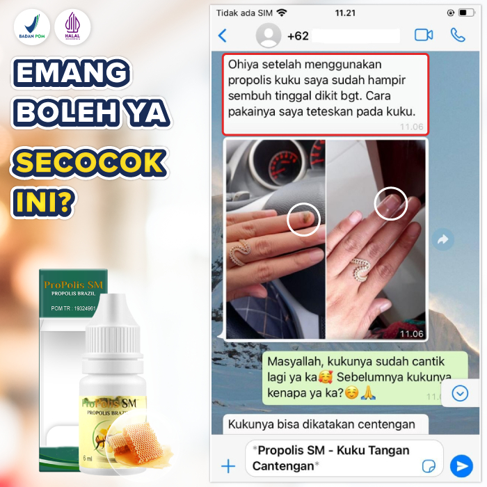 Obat Cantengan Jempol Kaki Tangan Bengkak Bernanah Jamuran