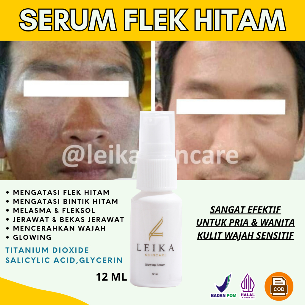 Serum Penghilang Flek Hitam membandel Pria Bpom Serum penghilang flek hitam di wajah penghilang flek