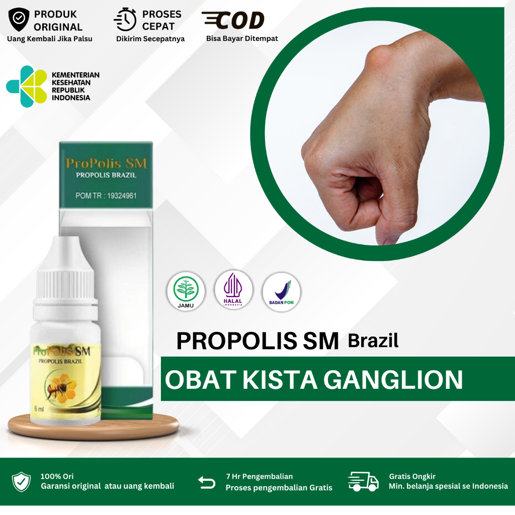 Obat Benjolan Di Tangan, Obat Benjolan di Tangan, Obat Kista Ganglion, Obat Penghancur Benjolan Di T