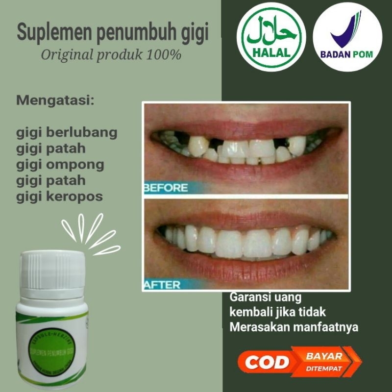 SUPLEMEN PENUMBUH GIGI BOLONG,PATAH,BERLUBANGAMPUH ORIGINAL 100%