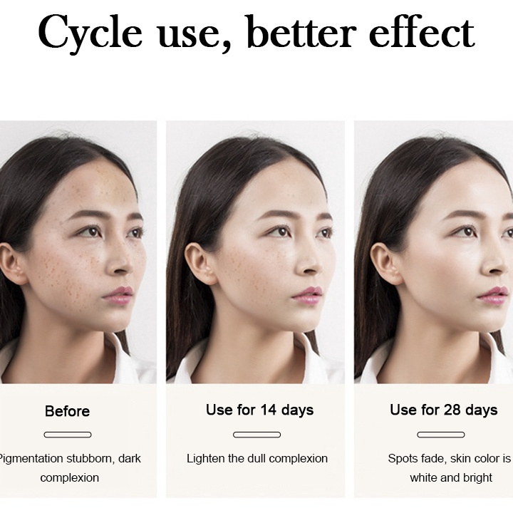 Seller SK FI DIOR - SK Whitening Freckle Cream Remove Dark Spots Anti Freckle Cream Niacinamide Fade