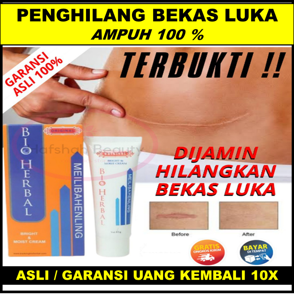 penghilang bekas luka hitam koreng Obat Penghilang Bekas Luka Menghilangkan Bekas Luka Lama Hitam Ko