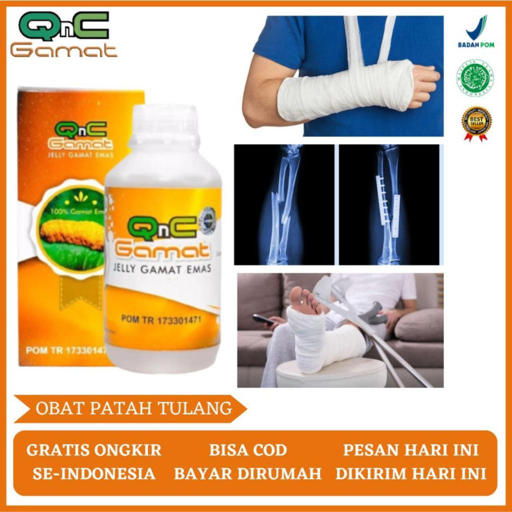 Suplemen Untuk Patah Tulang, Patah Tulang Kaki, Patah Tulang Tangan, Tulang Retak, Tulang Bergeser, 