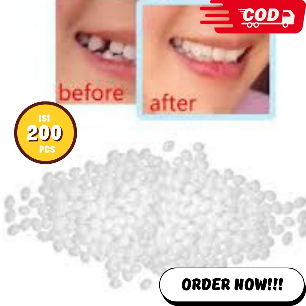 TEMPTOOTH GIGI PALSU 200 BUTIR BUAT GIGI PALSU GIGI PALSU GIGI BERLUBANG GIGI PATAH GIGI RENGGANG