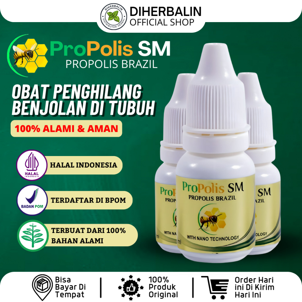 Obat Benjolan Di Tangan Kista Ganglion / Obat Benjolan Di Miss V Kista Bartholin Penghilang Benjolan