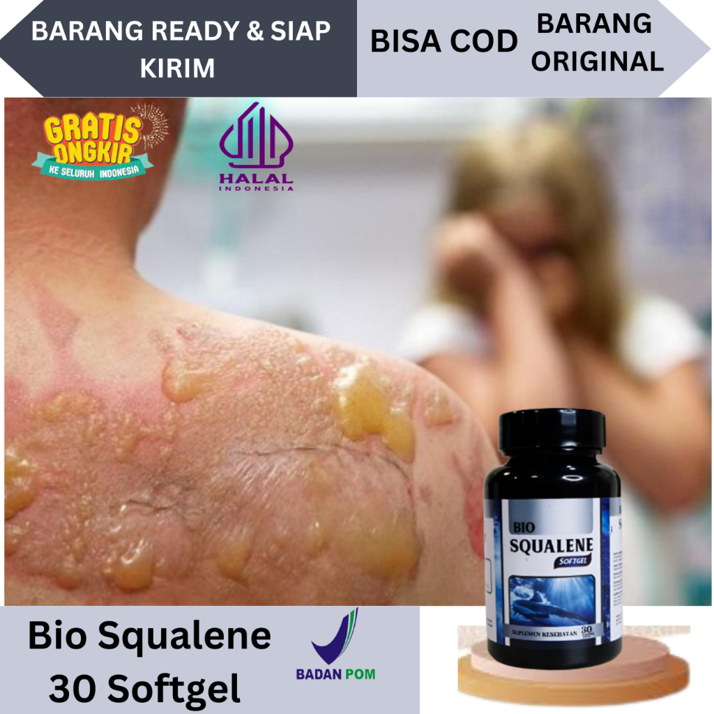 Obat Luka Bakar Melepuh Obat Luka Bakar Agar Cepat Kering Obat Luka Bakar Melepuh  Kena Knalpot Obat