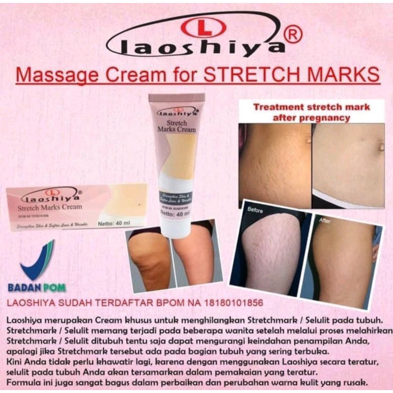 LAOSHIYA STRECTH MARKS CREAM ORIGINAL BPOM | LAOSHIYA SELULIT