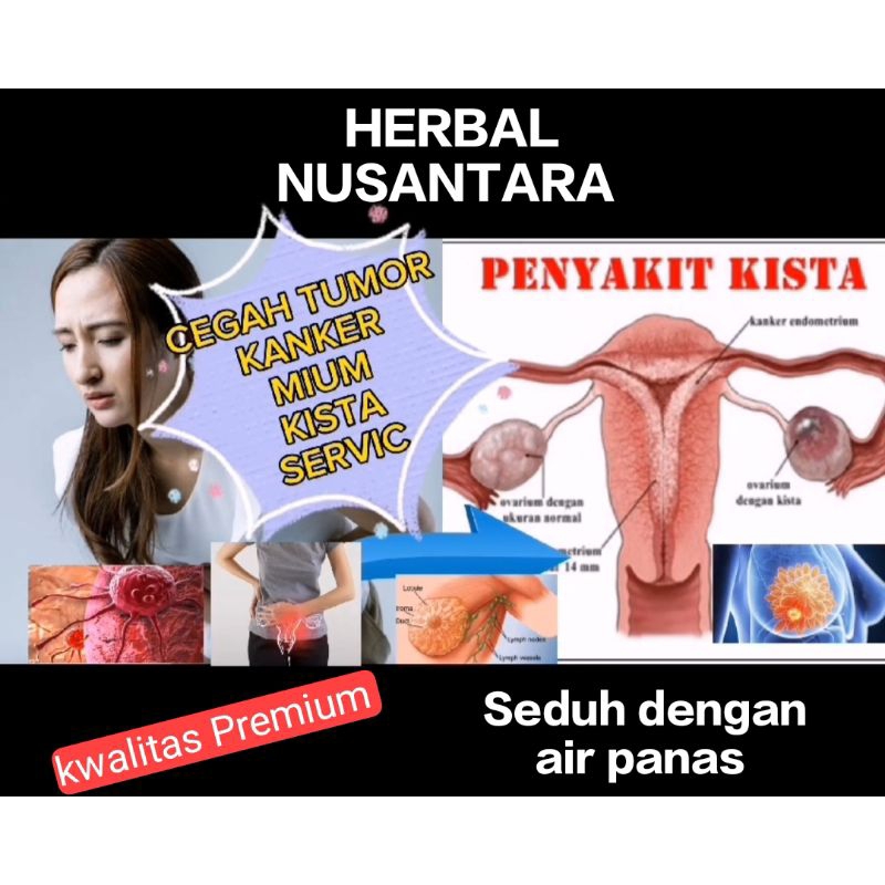 

HERBAL, TUMOR, KANKER,KISTA, MIUM.MEMATIKAN SEL KANKER DAN TUMOR.AMPUH.UNTUK 6 GELAS TGGL SEDUH