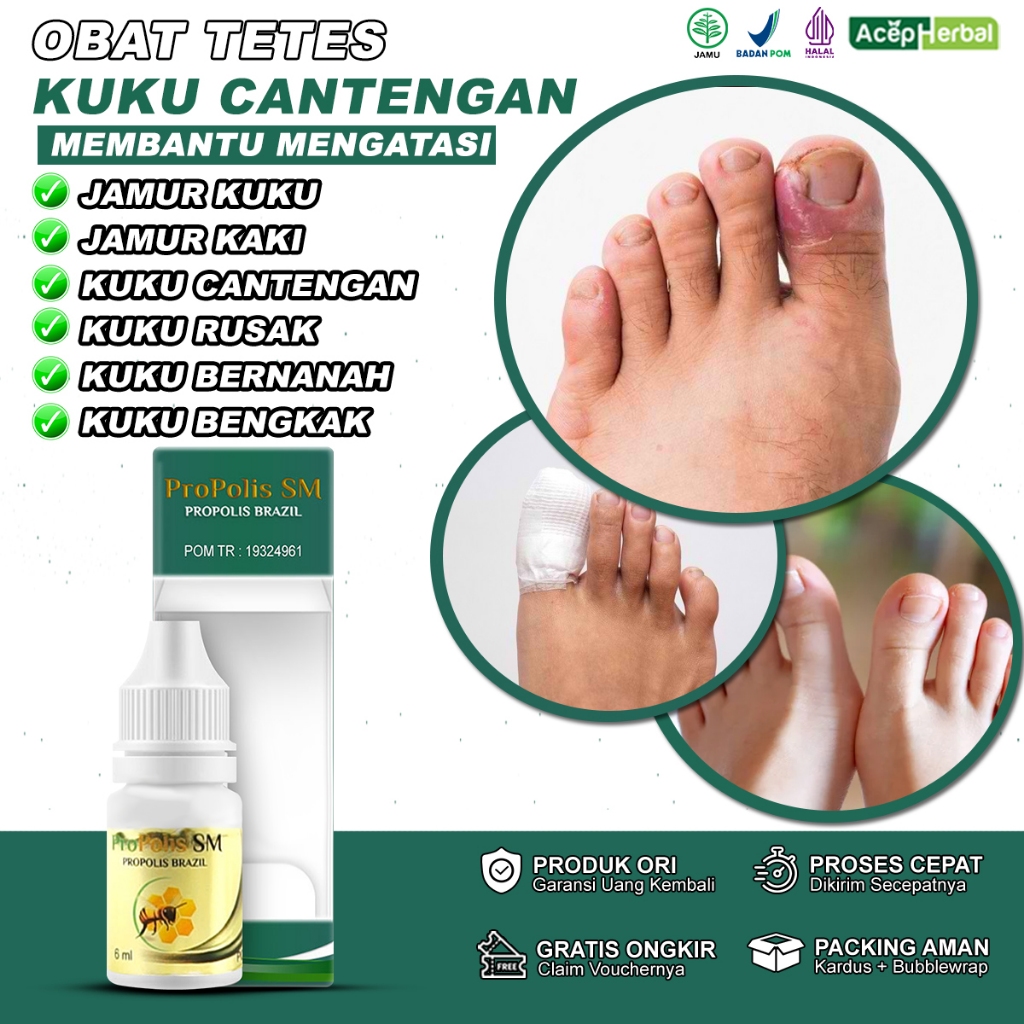 Obat Jamur Kuku Obat Kuku Jamur dan Rusak Obat Cantengan Jempol Kaki Obat Kuku Cantengan Obat Kuku R