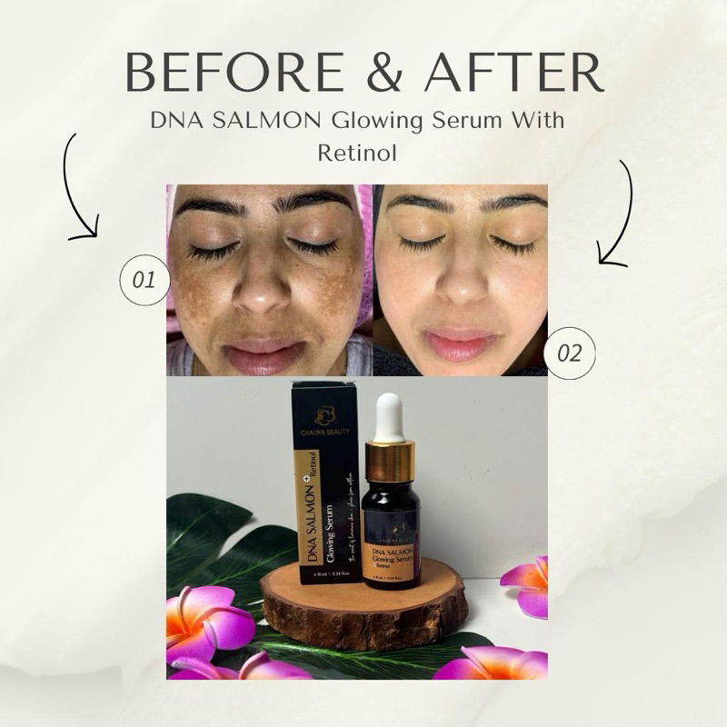 SERUM FLEK DNA SALMON CHALWA BEAUTY