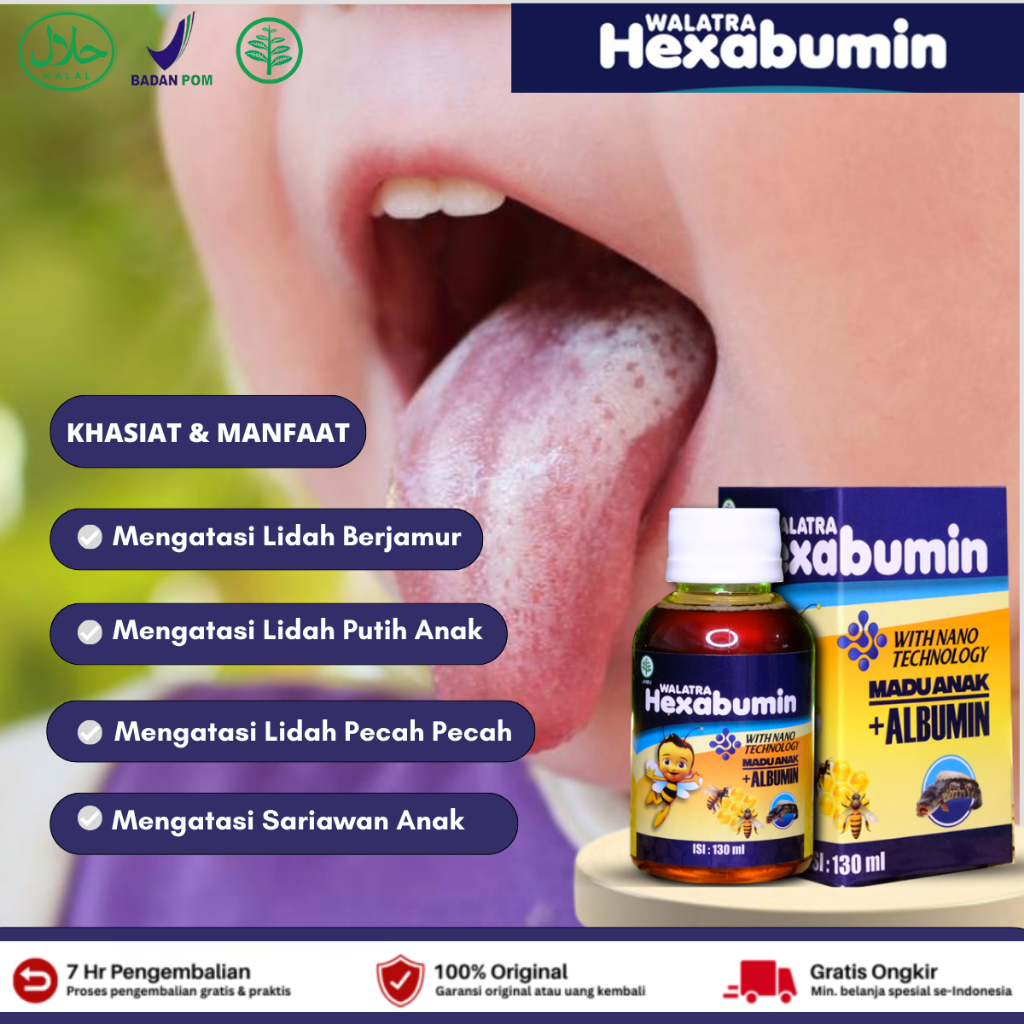 Obat Lidah Putih Anak, Obat Lidah Berjamur, Obat Pembersih Lidah Putih, Lidah Putih Terasa Pahit, Ja