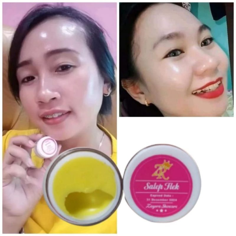 VIRAL SALEP FLEK ZAYORA 5GR 100% ORI AMPUH MENGHILANGKAN FLEK HITAM
