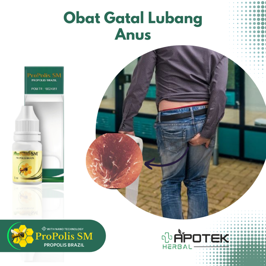 Obat Anus Gatal Pruritus Ani Infeksi Cacing Kremi Gatal Lubang Anus Anus Lecet Perih Bengkak Ruam Ke