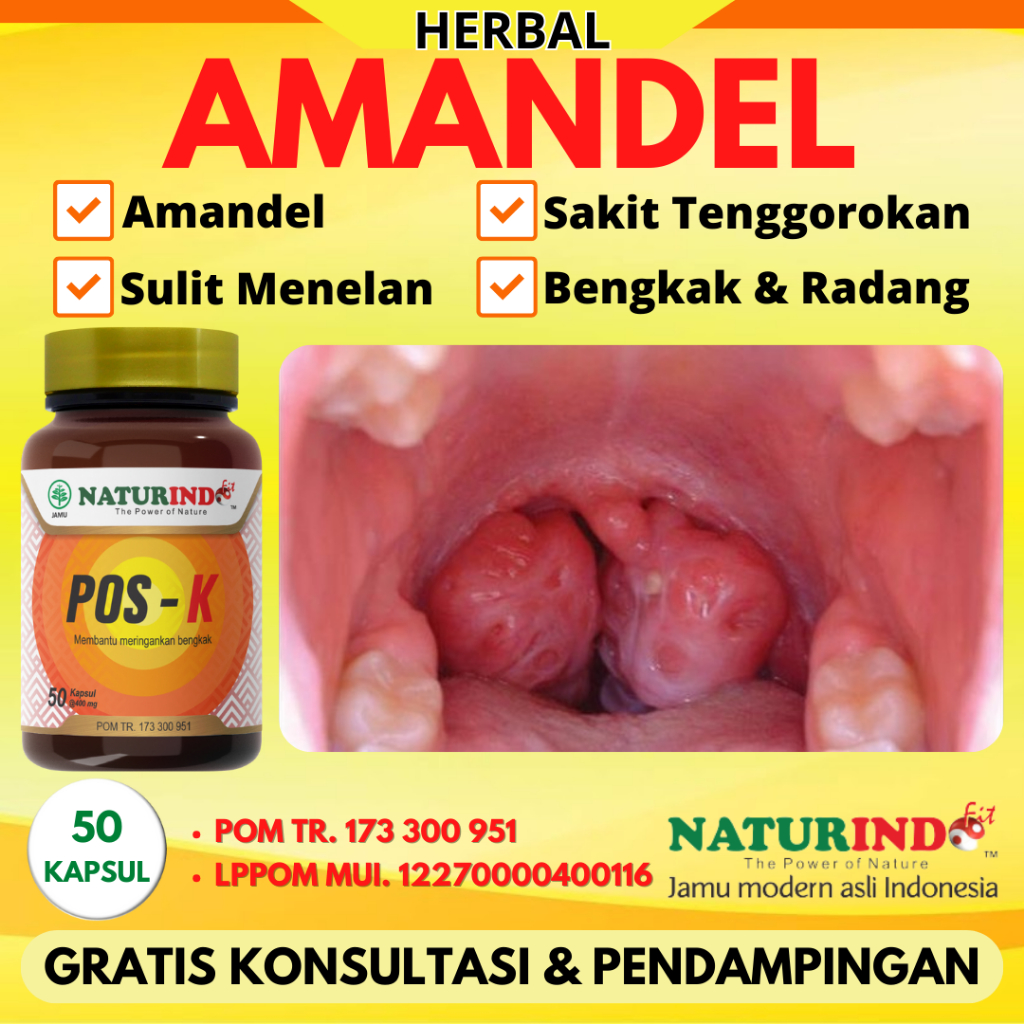 Obat Herbal Amandel Sakit Radang Tenggorokan Dewasa