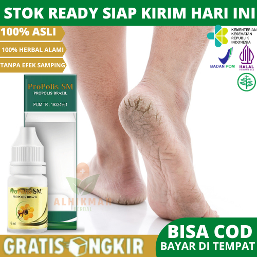 Obat Kaki Pecah Dan Kering, Obat Penghalus Tumit Kaki, Obat tetes Cair Untuk Kaki Pecah pecah Roromb