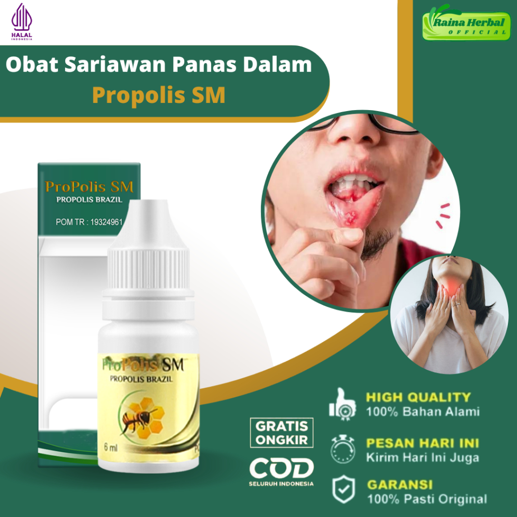 Obat Sariawan Di Bibir Mulut Lidah Panas Dalam Bibir Kering Pecah Pecah Radang Tenggorokan Sakit Sus