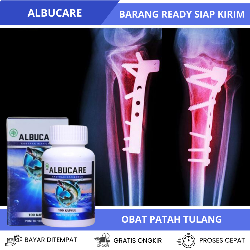Obat Patah Tulang, Obat Tulang Retak, Obat Tulang Remuk, Obat Tulang Cedera, Obat Tulang Terkilir, O