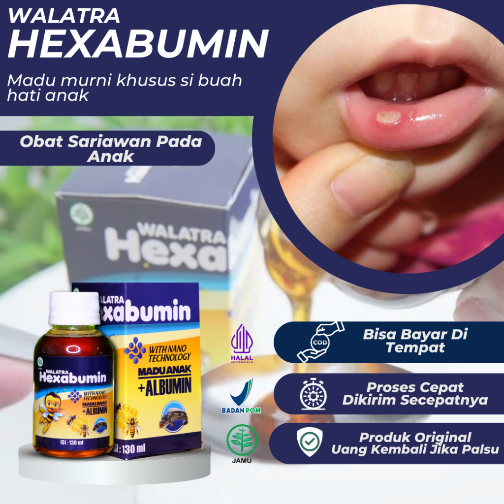 Hexabumin Madu Anak - Madu Atasi Sariawan Pada Anak, Bibir Pecah Pecah, Sariawan Di Lidah, Sariawan 