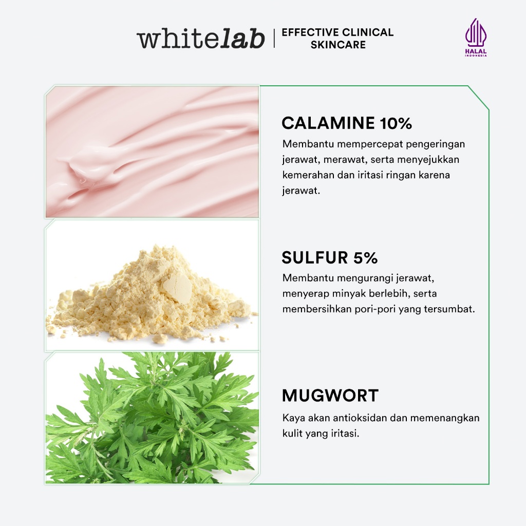 Whitelab Acne Cream - Krim Totol Atasi Jerawat Dalam 2 Hari Dengan Sulfur, Calamine & Mugwort [BPOM] Image 3