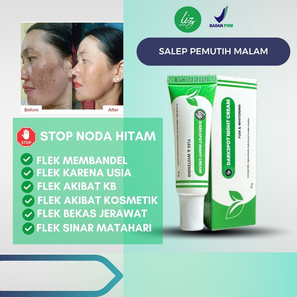 Salep Darkspot Night Elzet Skincare BPOM penghilang flek hitam membandel original Salep Night Whiten