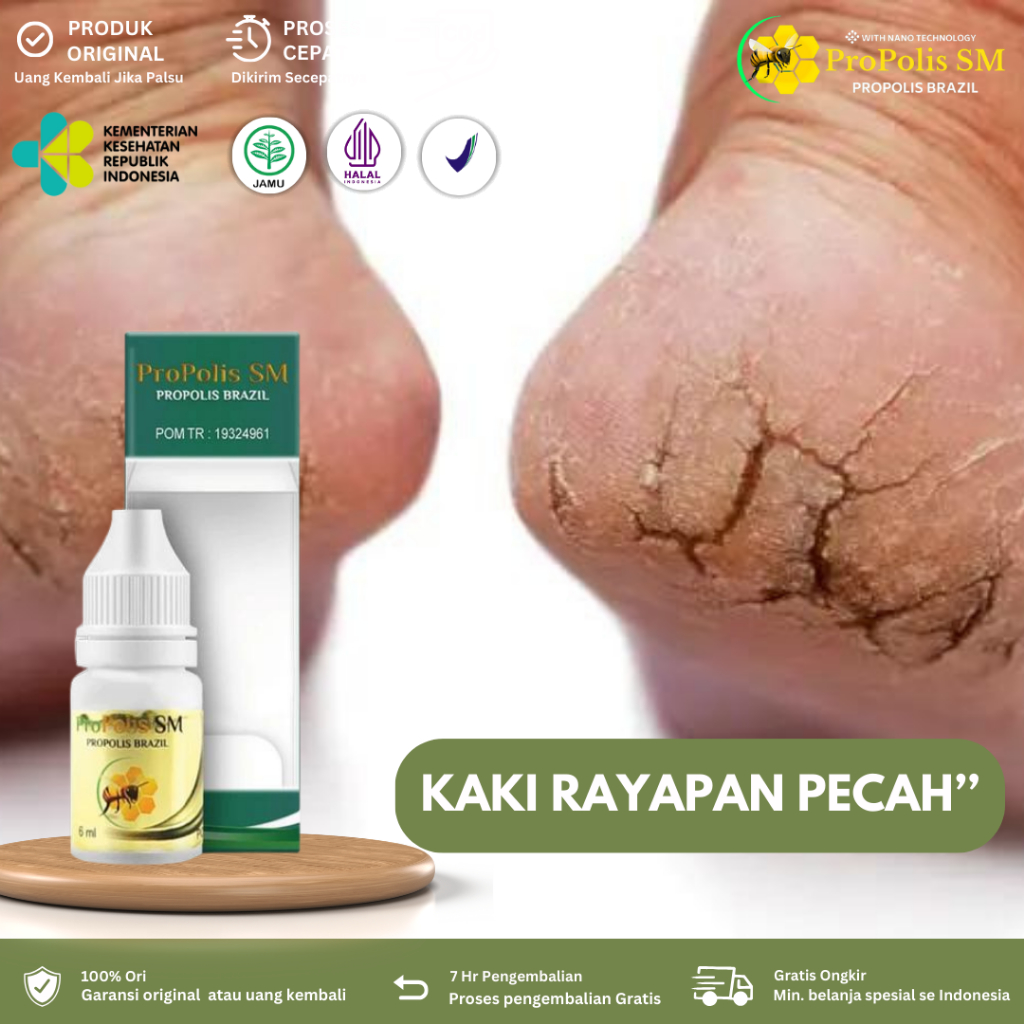 Obat Kaki Rayapan, Penghilang Rorombeheun, Obat Kaki Bolong Bolong Kecil, Kaki Rayapan Bau, Telapak 