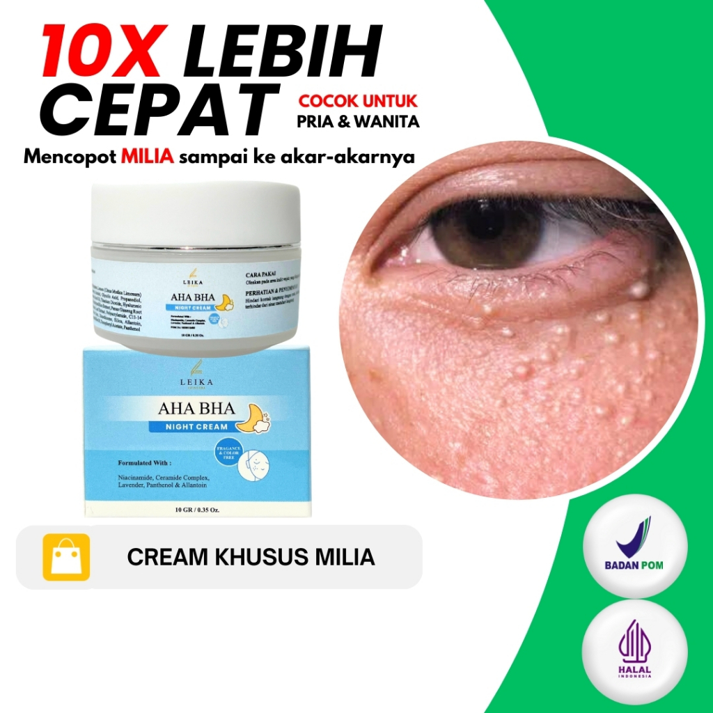 MILIA COPOT ! CREAM KHUSUS MILIA Cream khusus MILIA dibawah mata kelopak mata pipi hidung jidat Meng