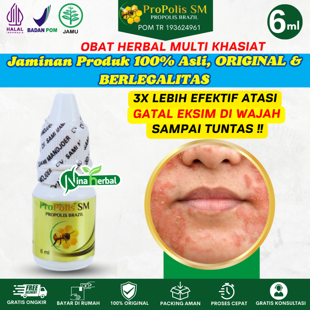 [BISA COD] Obat Gatal Eksim di Wajah Leher Telinga Pergelangan Tangan Siku Kaki Exsim Kering Menahun