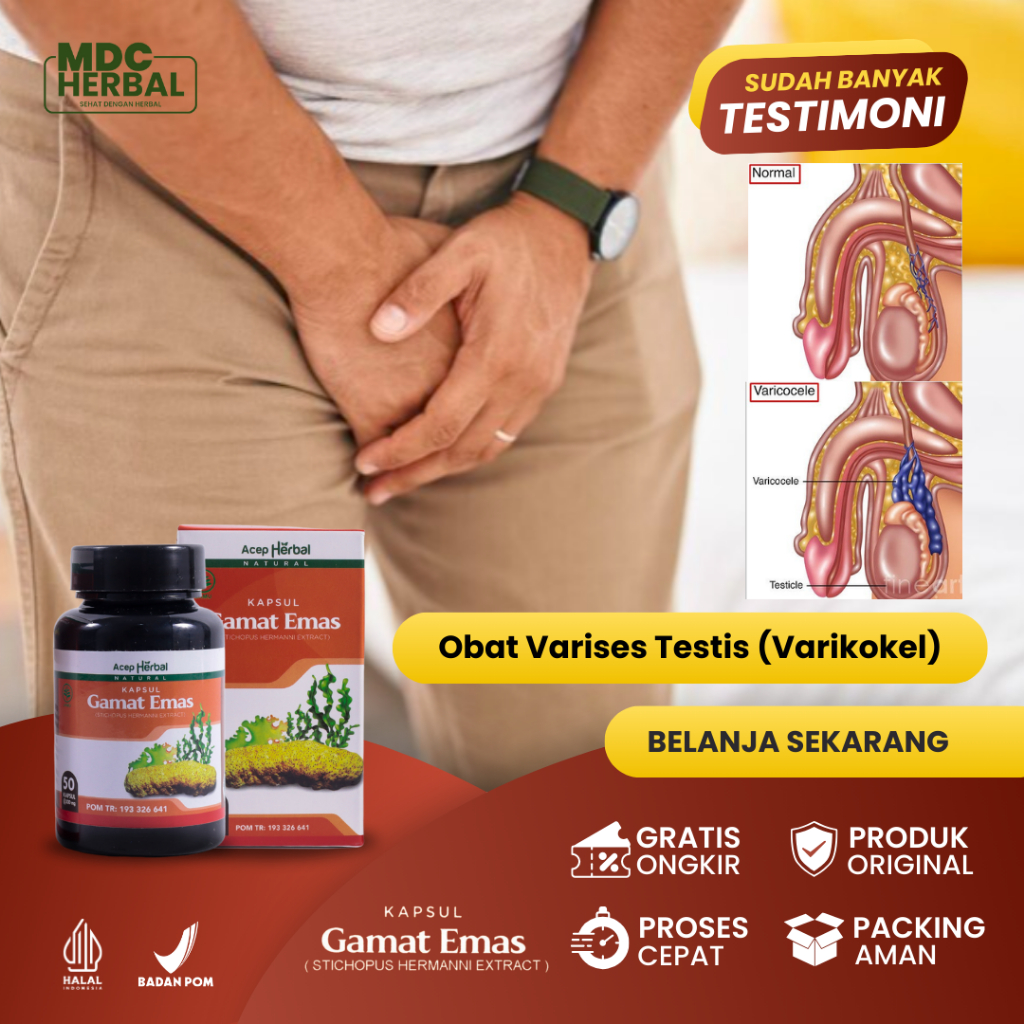 Obat Varises di Buah Zakar, Obat Varikokel, Pengempes Urat Varises Testis, Obat Buah Zakar Besar Seb