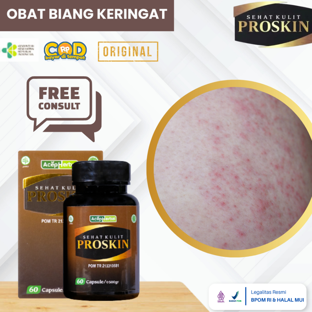 Obat Biang Keringat, Obat Biang Keringat Gatal Pada Kulit, Miliaria Rubra, Bintik Bintik Di Badan, G