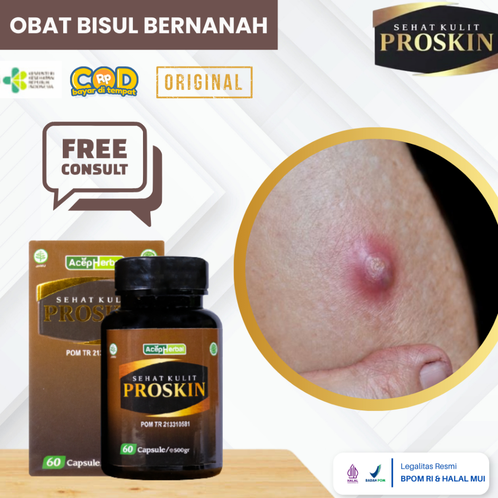 Obat Bisul, Obat Penghilang Bisul, Obat Bisul Di Pantat, Bisul Di Kemaluan, Obat Bisul Di Ketiak, Ob