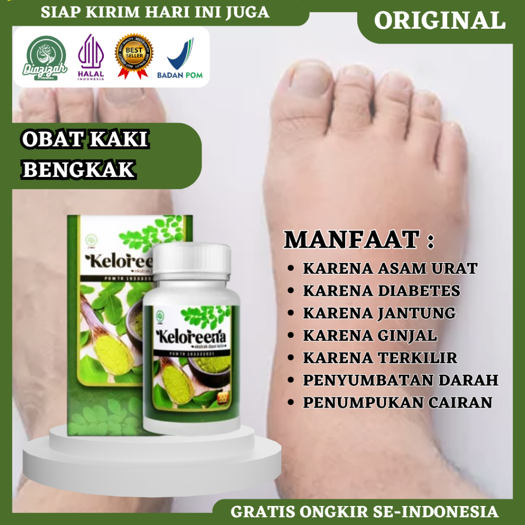Obat Kaki Bengkak, Obat Kaki Bengkak Karena Diabetes, Obat Kaki Bengkak Karena Jantung, Obat Kaki Be