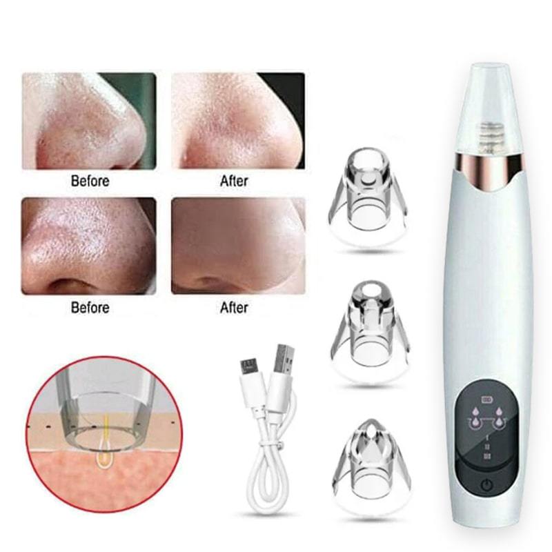 Remove Blackhead Alat Vacum Penyedot Komedo / Alat Sedot Komedo Penghilang Penyedot Komedo