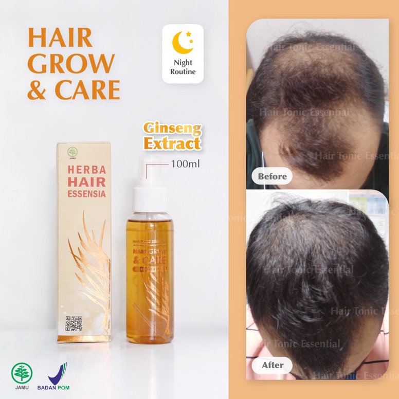 Hair Tonic Essential Kuning  Yellow 1 ML  Hair Grow Penumbuh Rambut BPOM Beli 8 Gratis 1