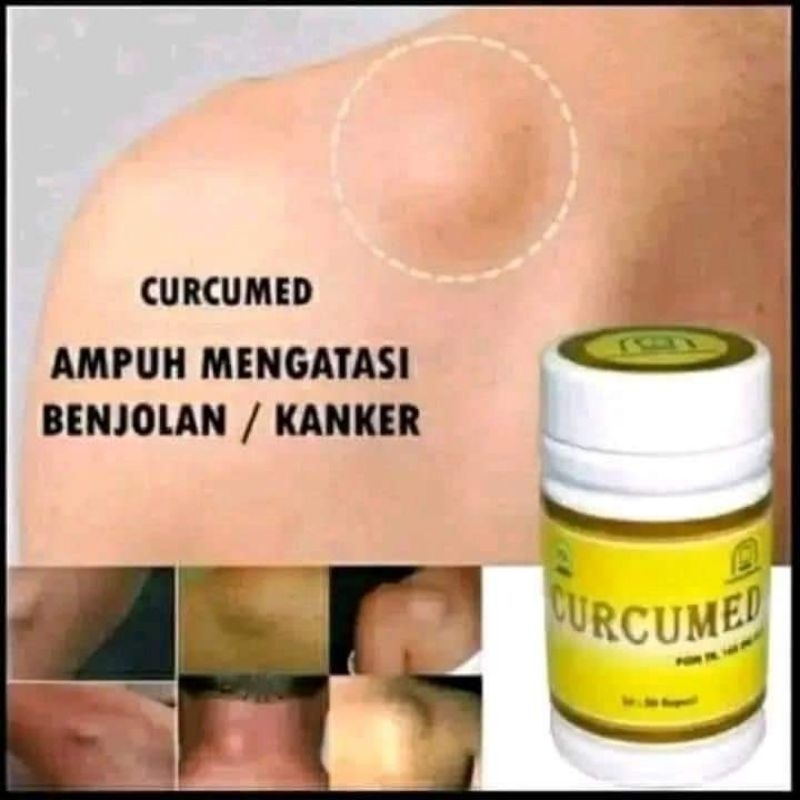 CURCUMED NASA - PENCEGAH KANKER DAN TUMOR