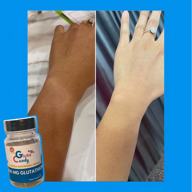 

Gluta Candy 2x Whitening
