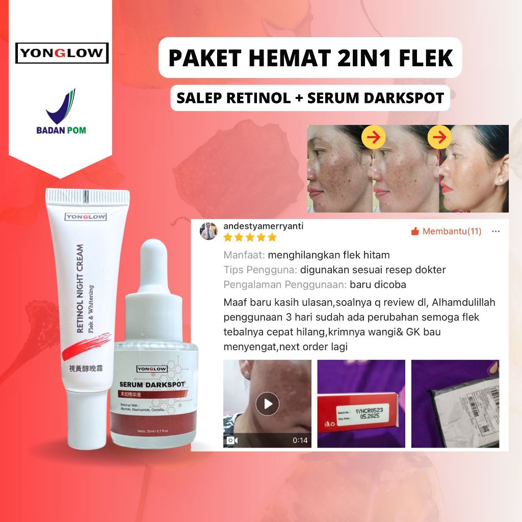 Paket 2in1 Yonglow Paket Salep Retinol Cina BPOM Serum Darkspot Penghilang Flek Hitam Melasma Bintik