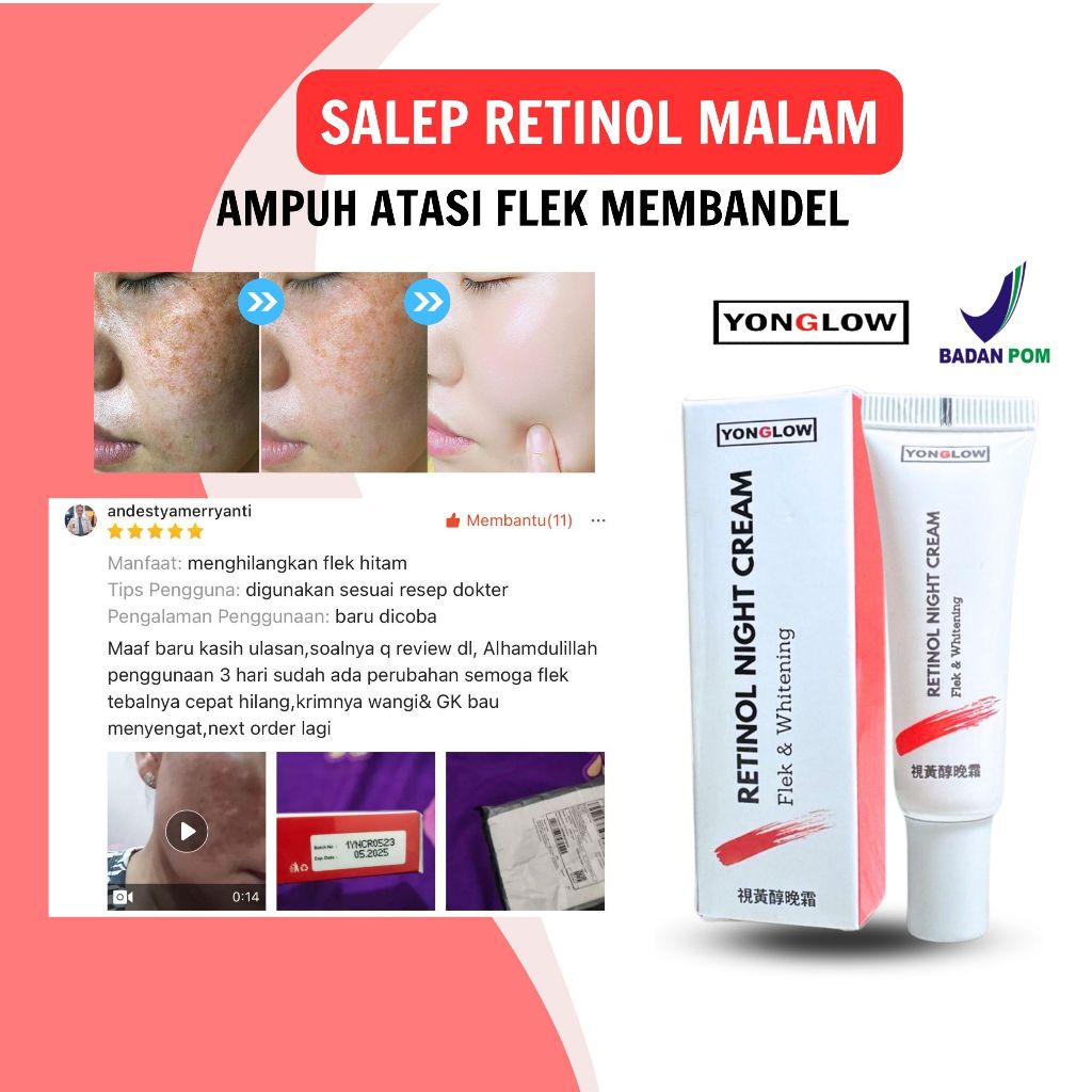 Salep Retinol Cina Yonglow BPOM Salep Penghilang Flek Bintik Hitam Wajah Krim Pemutih Wajah Kusam Gl