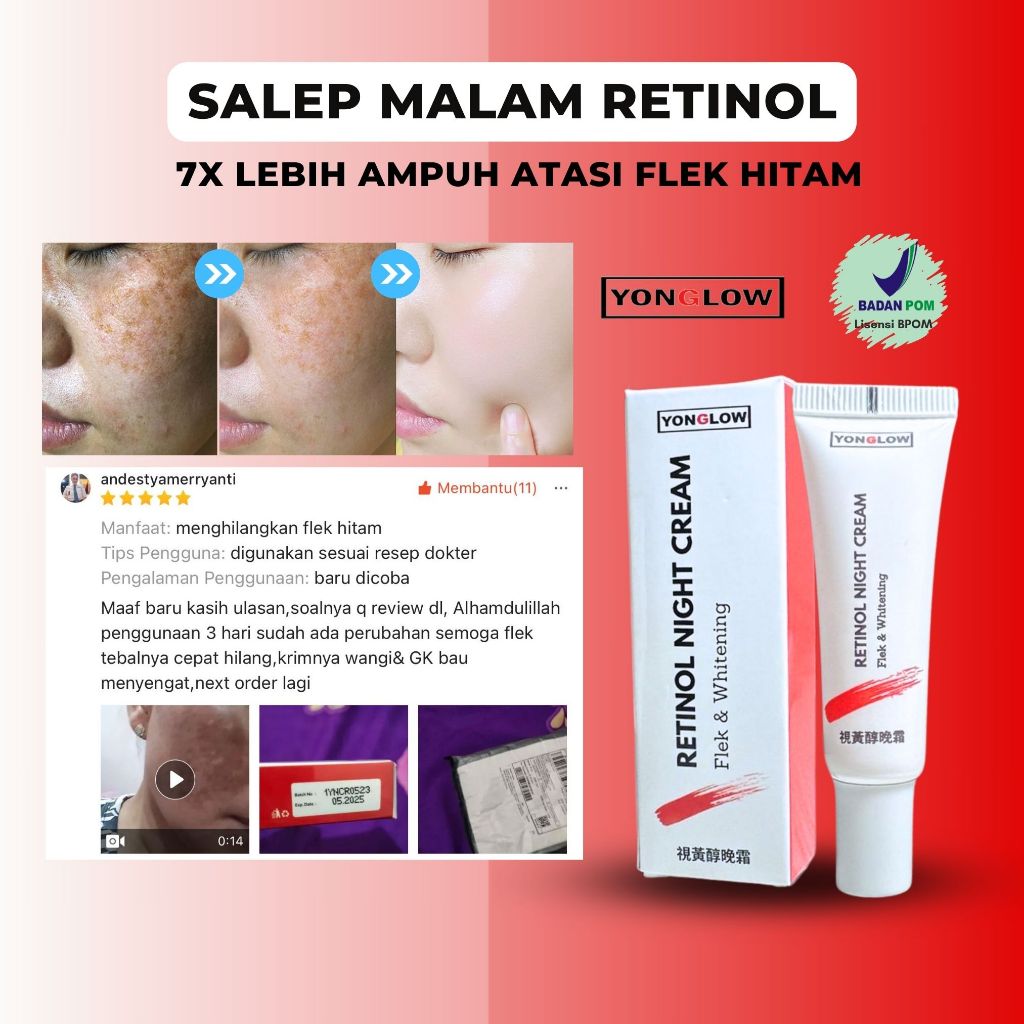 Salep Flek Cina BPOM Retinol Night Cream Yonglow Skincare Salep Penghilang Flek Melasma Bintik Hitam
