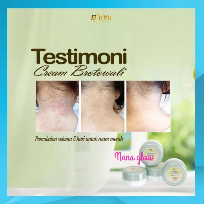 Bnyu Cream Brotowali Untuk Jerawat Bruntusan & Gatal-Gatal