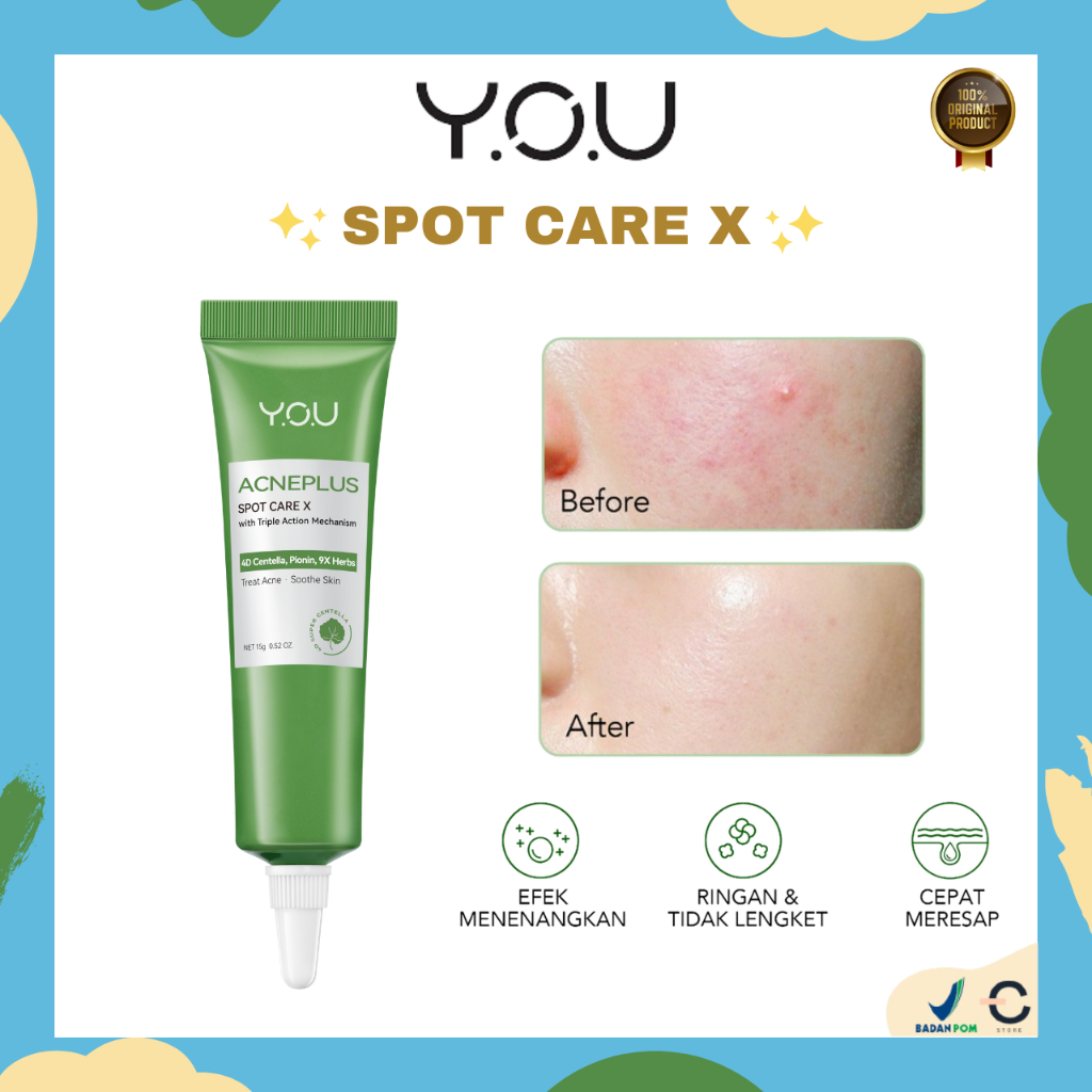 [ORI BPOM] YOU AcnePlus Spot Care X 15g | Obat Totol Jerawat Centella dan Bekas Jerawat