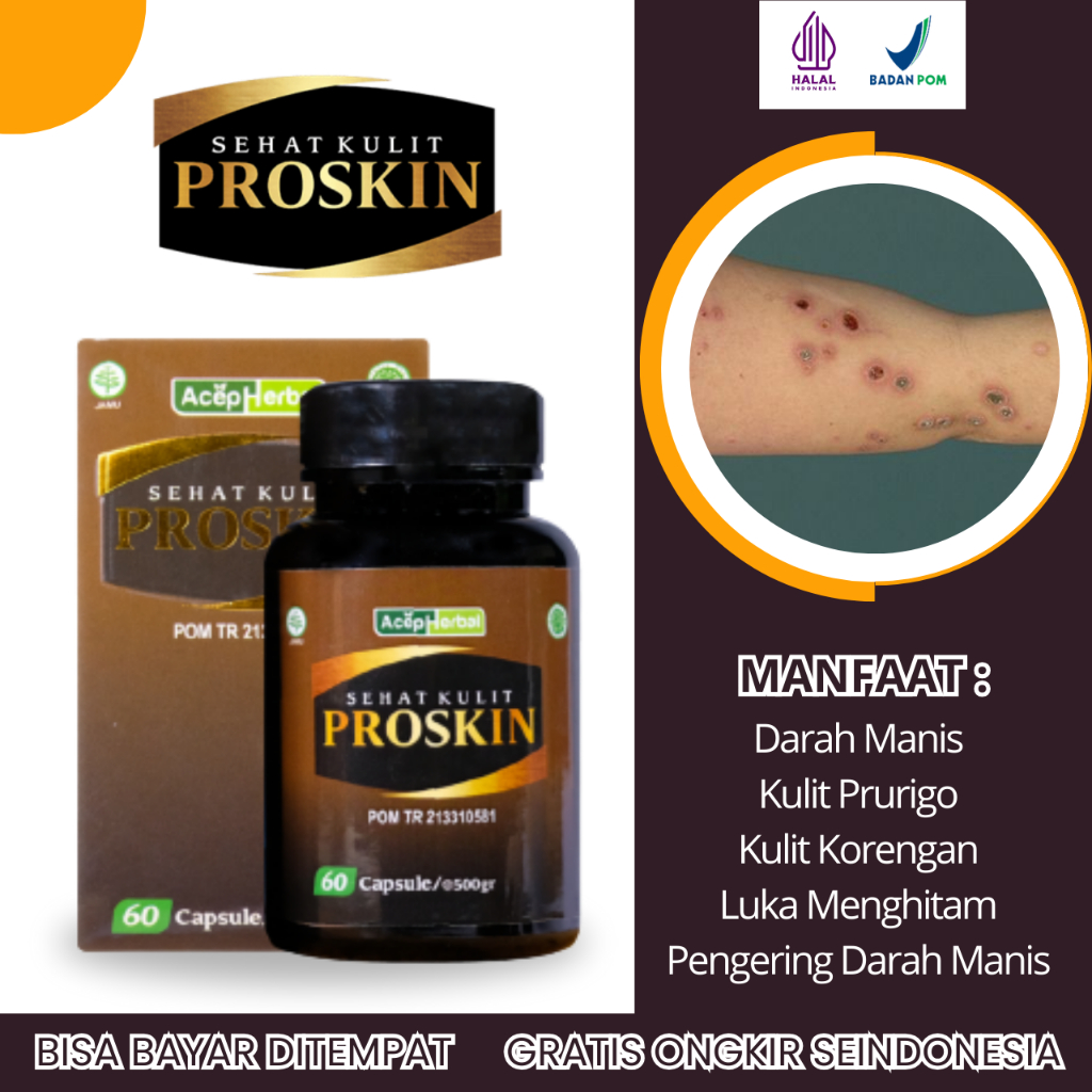 Obat Darah Manis, Obat Kulit Gatal, Obat Kulit Korengan, Obat Luka Bernanah, Obat Gatal Kulit Darah 