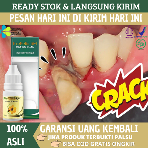 Obat Sakit Gigi Goyang, Sakit Gusi Bengkak Berdarah, Obat Pereda Nyeri Gigi, Obat Tetes Sakit Gigi, 