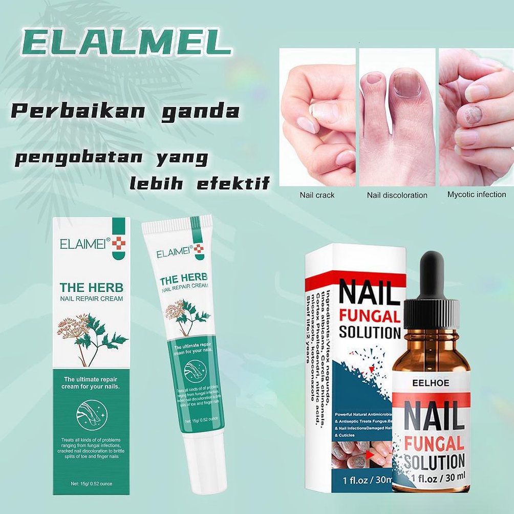 ART I15P ELAIME Obat Krim Jamur Kuku Obat Kuku Jamur Dan Rusak Perawatan KukuNail Repair Cream Essen