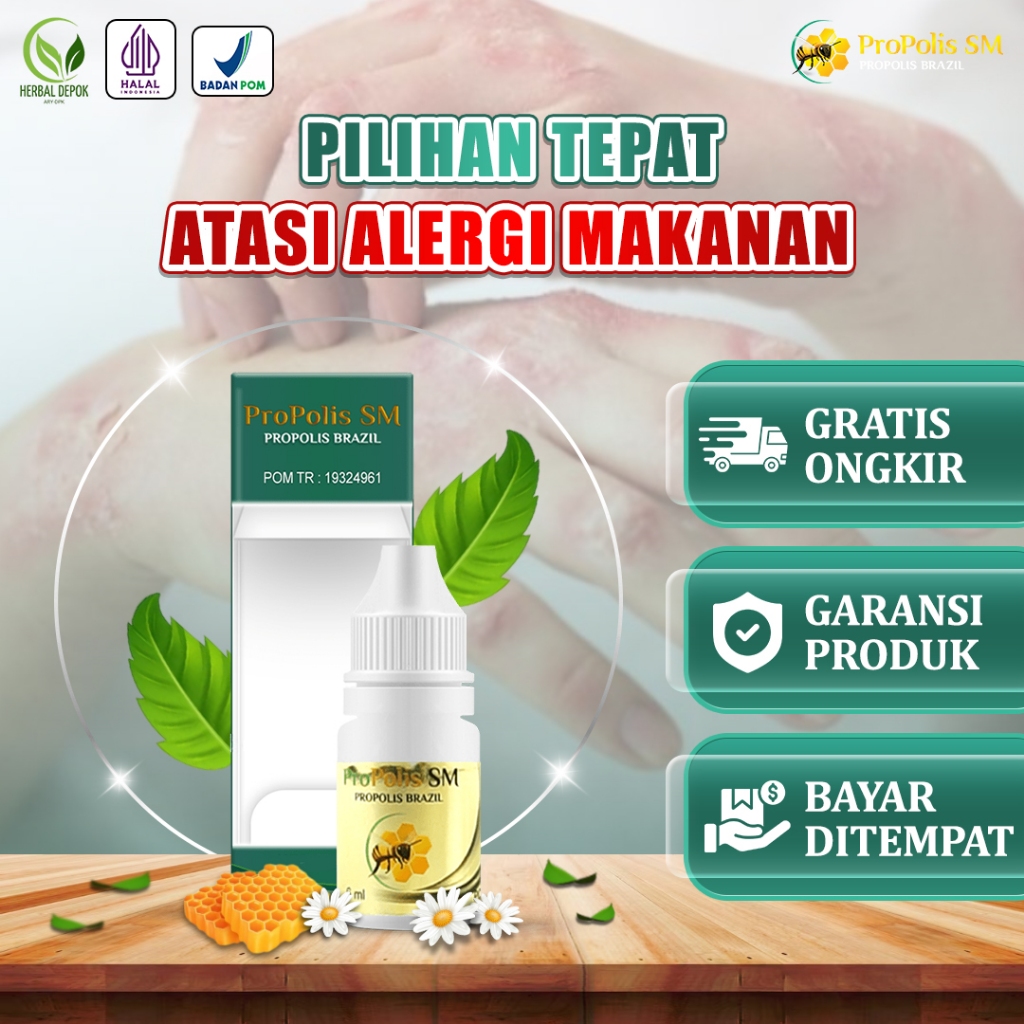 Obat  Alergi Gatal-Gatal -Alergi Makanan , Dermatitis Atopik Alergi Dingin Herbal Propolis SM