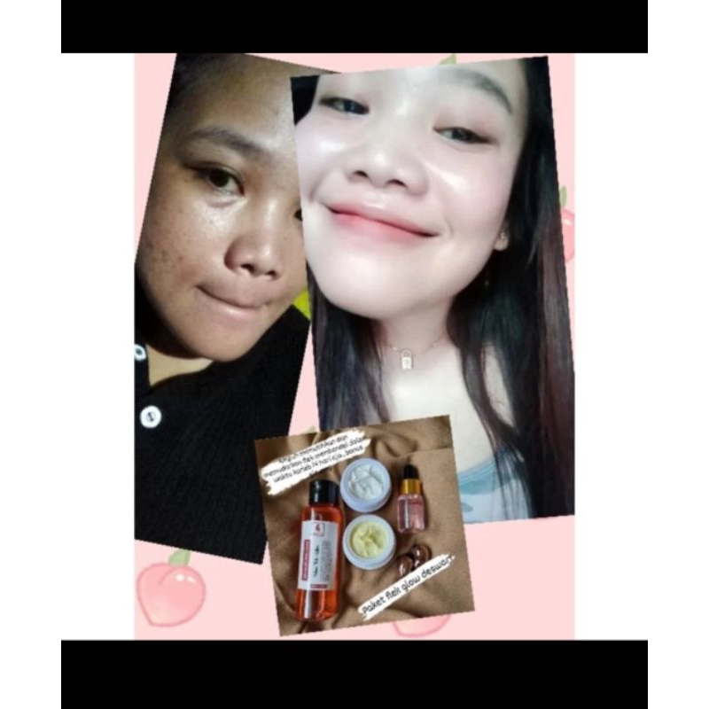 PAKET FLEK DESWARI SKINCARE BPOM